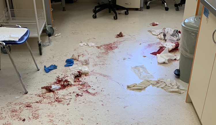 Muž, který útočil mačetou v nemocnici, nebyl příčetný. Trestní stíhání bylo zastaveno