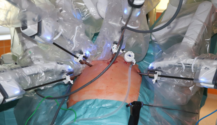 Fakultní nemocnice obnovila robotické operace, dva měsíce od požáru se škodou 18 milionů