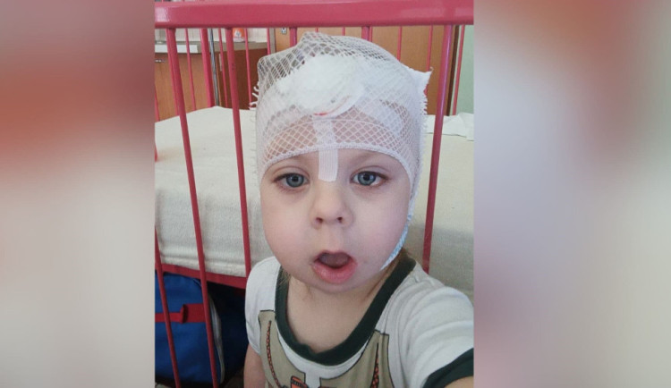 Dominik se narodil se třemi oušky a rozštěpem rtu, lékaři u něj objevili vzácné onemocnění