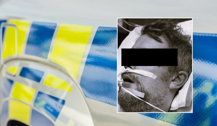 Zemřel surově zbitý muž, kterého našli ležet bez bot na ulici, případu se věnují kriminalisté