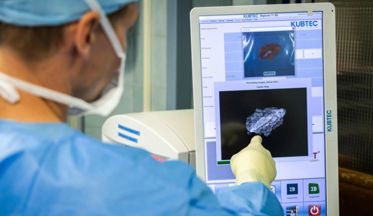 FN Ostrava má jako první v regionu špičkový přístroj na operace nádorů prsu