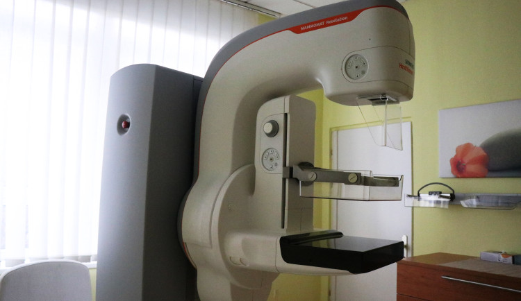 Stalo se před třiceti lety: Novoměstská nemocnice pořídila vůbec první mamograf