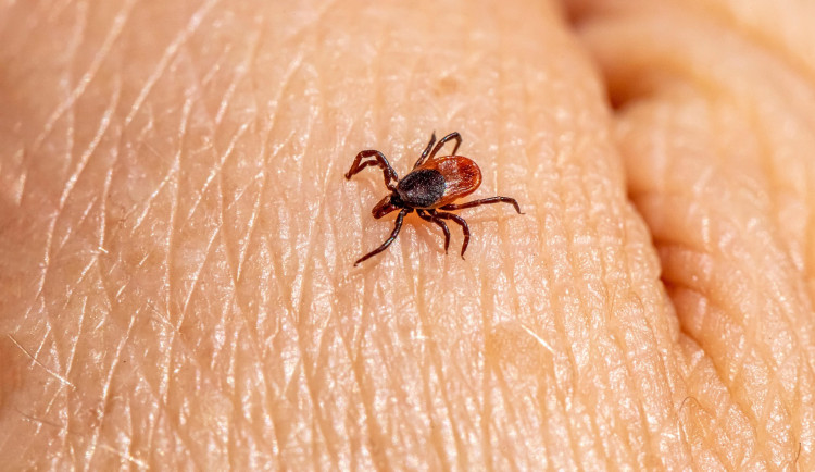 Klíšťata jsou zpět. Na Vysočině výrazně přibylo případů nákazy, varují hygienici